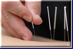 Acupuncture