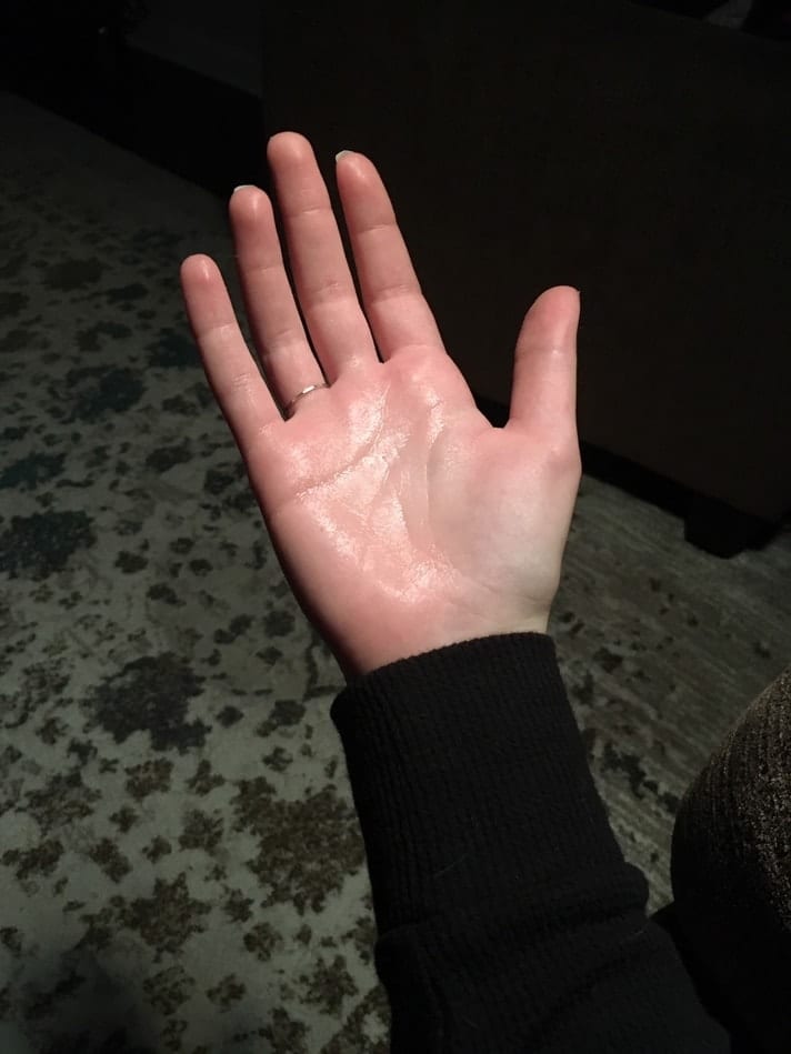 sweaty hand